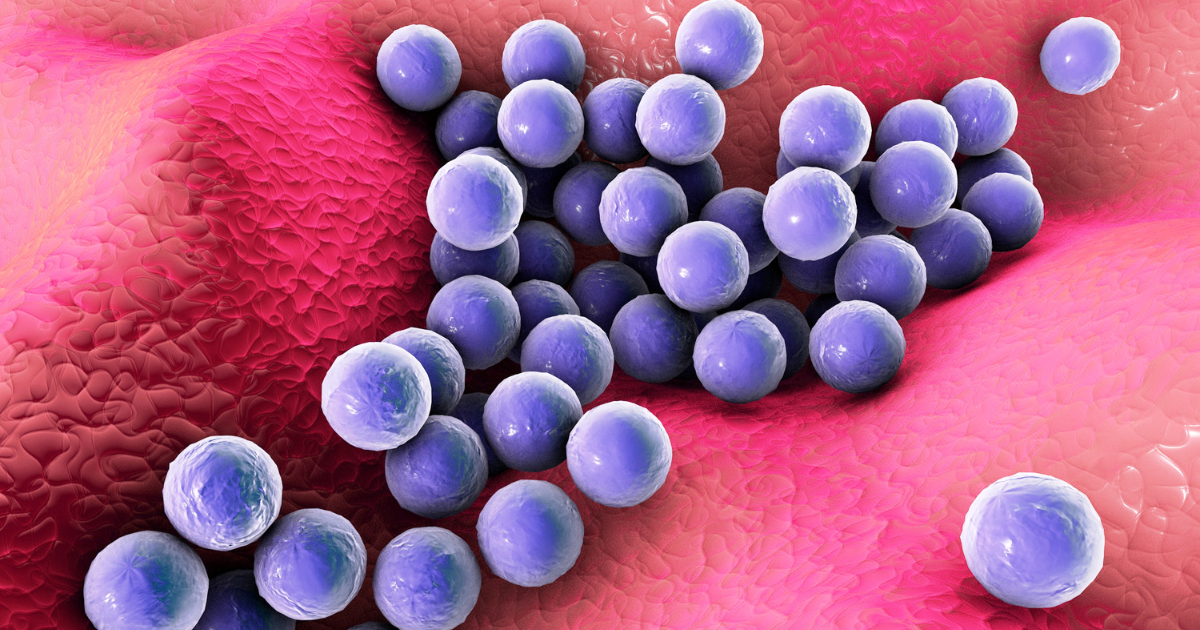 Sepsis Misdiagnosis: When to Contact a Medical Malpractice Lawyer